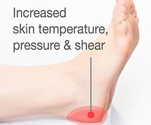 Protect the Heels with Evidence Based Interventions