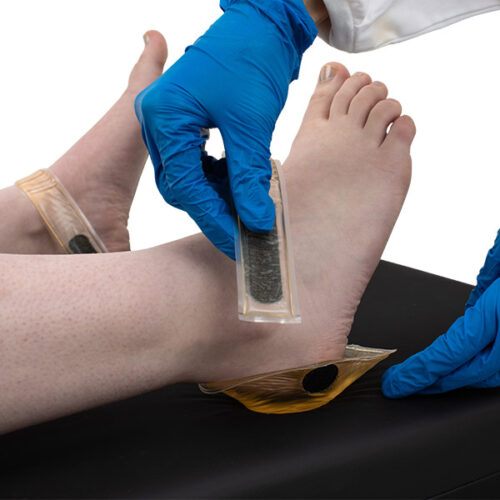 Heel Comfort Cup Set being applied to a patient by a nurse.